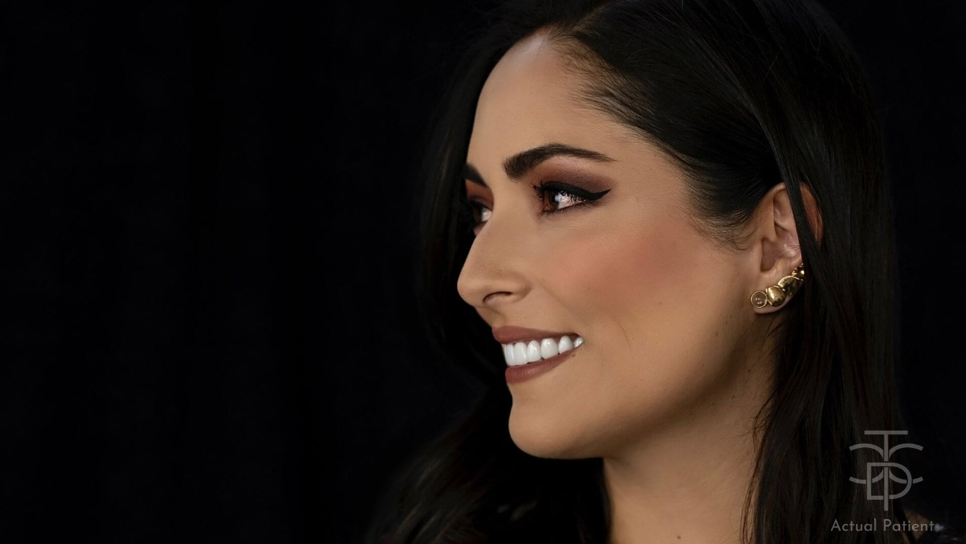 fix my smile side profile of g